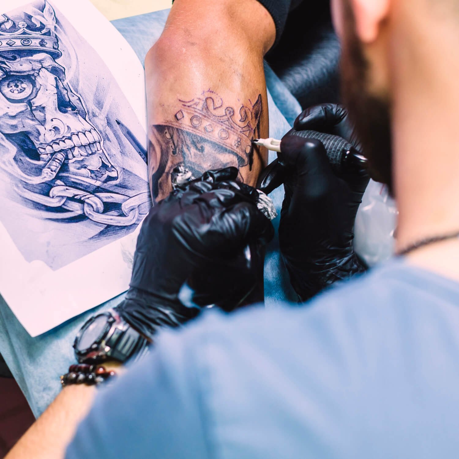 a man with diabetes getting a tattoo